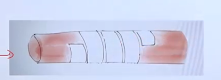 post-thumbnail