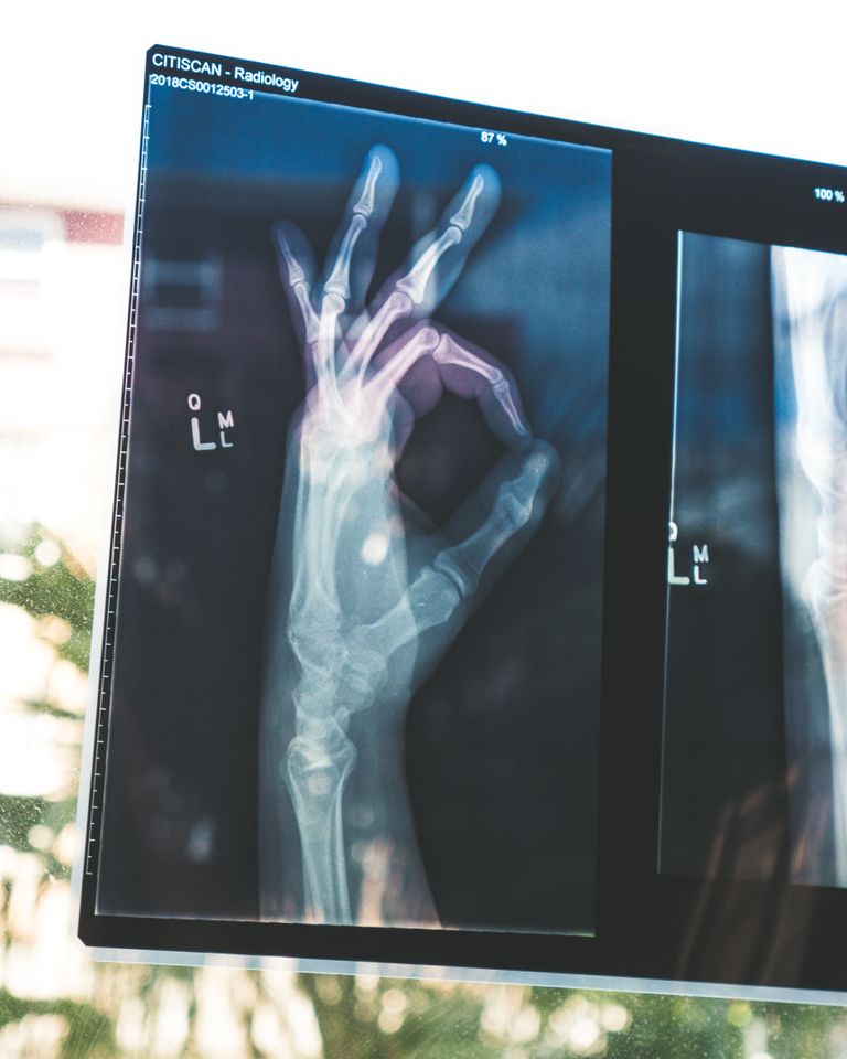 post-thumbnail
